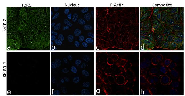 TBK1 Antibody in Immunocytochemistry (ICC/IF)