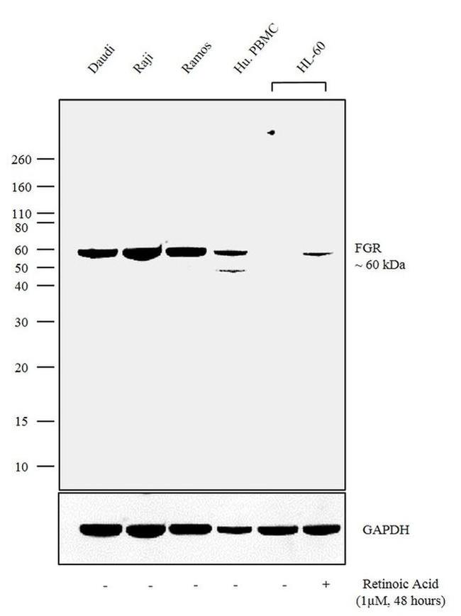 FGR Antibody in Western Blot (WB)