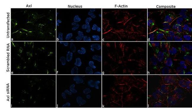 Axl Antibody in Immunocytochemistry (ICC/IF)