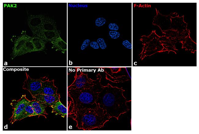 PAK2 Antibody in Immunocytochemistry (ICC/IF)