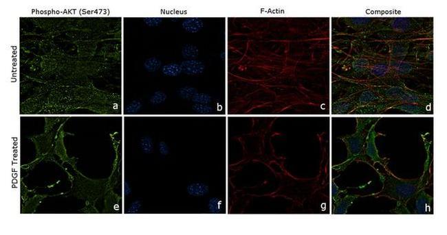 Phospho-AKT1 (Ser473) Antibody in Immunocytochemistry (ICC/IF)