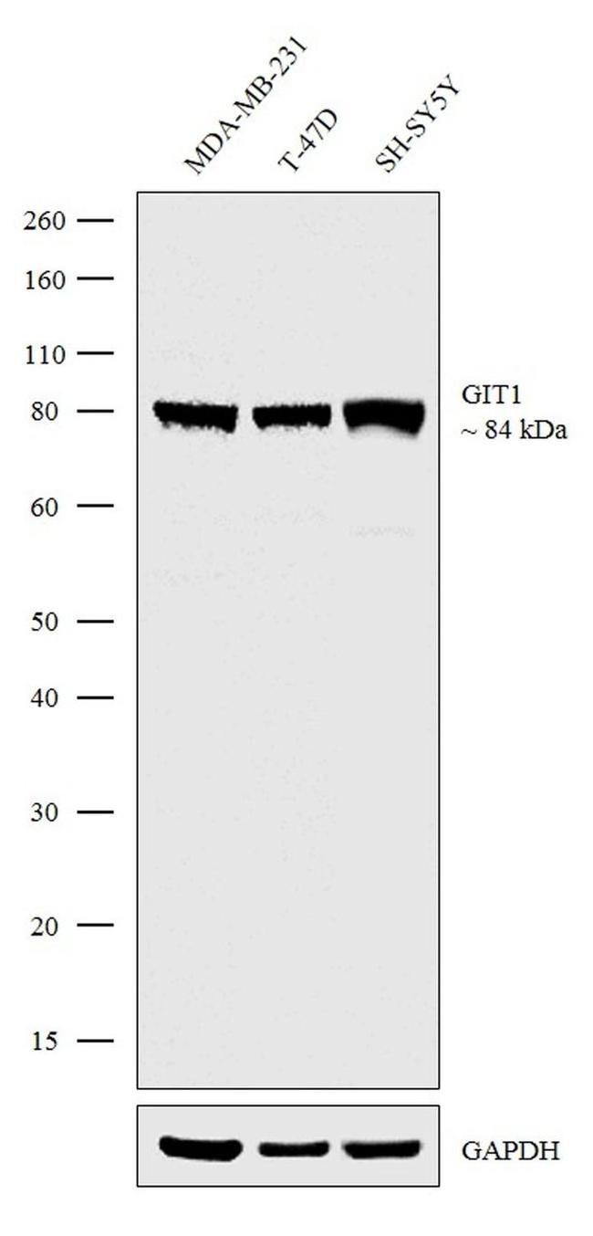 GIT1 Antibody in Western Blot (WB)