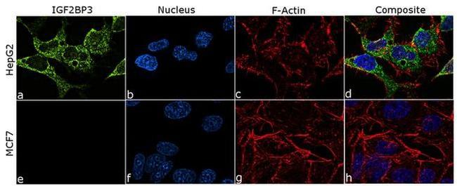 IGF2BP3 Antibody in Immunocytochemistry (ICC/IF)