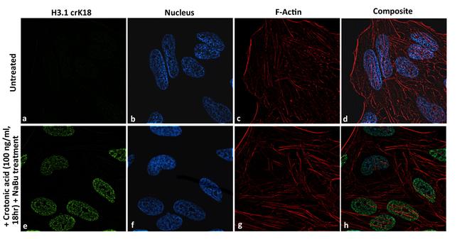 H3K18cr Antibody in Immunocytochemistry (ICC/IF)