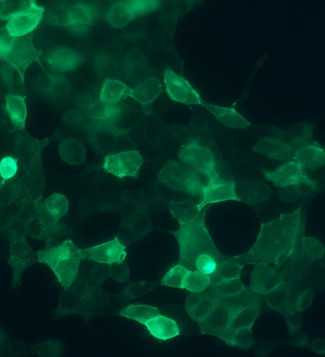 SSTR4 Antibody in Immunocytochemistry (ICC/IF)