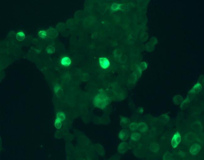 GPR30 Antibody in Immunocytochemistry (ICC/IF)