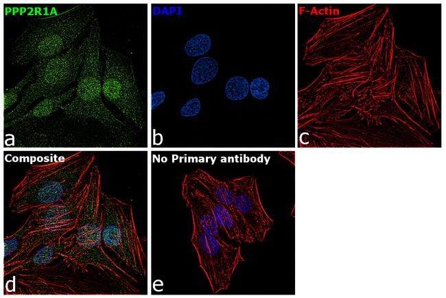 PPP2R1A Antibody in Immunocytochemistry (ICC/IF)