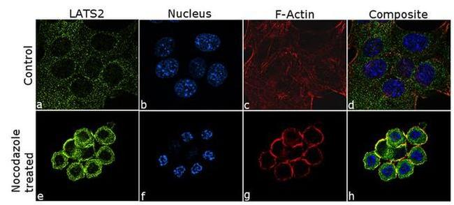 LATS2 Antibody in Immunocytochemistry (ICC/IF)