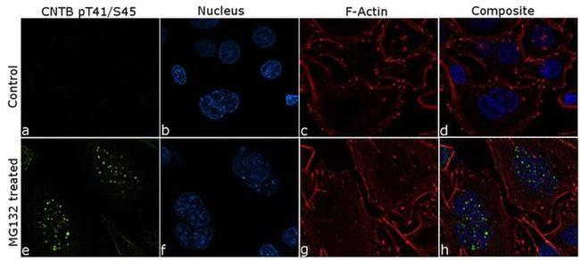 Phospho-beta Catenin (Thr41, Ser45) Antibody in Immunocytochemistry (ICC/IF)