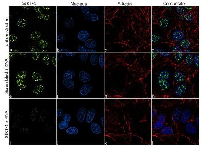 SIRT1 Antibody in Immunocytochemistry (ICC/IF)