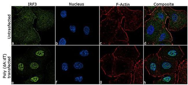 IRF3 Antibody in Immunocytochemistry (ICC/IF)