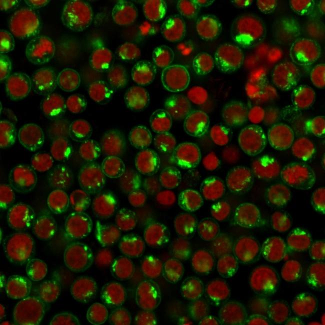 CD71/Transferrin Receptor (TFRC) Antibody in Immunocytochemistry (ICC/IF)