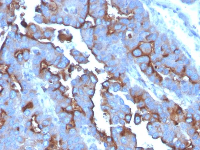 CD71/Transferrin Receptor (TFRC) Antibody in Immunohistochemistry (Paraffin) (IHC (P))