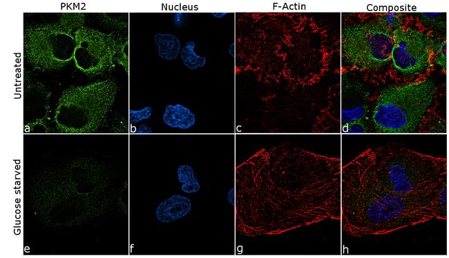 PKM2 Antibody in Immunocytochemistry (ICC/IF)