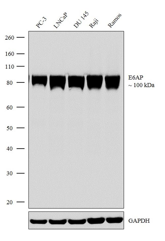 E6AP Antibody in Western Blot (WB)