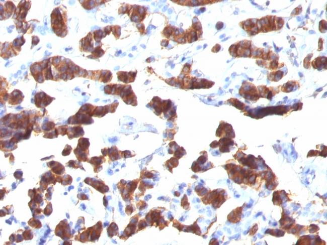 Thyroglobulin (Thyroidal Cell Marker) Antibody in Immunohistochemistry (Paraffin) (IHC (P))