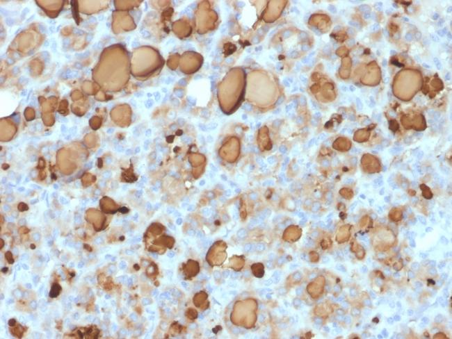 Thyroglobulin (Thyroidal Cell Marker) Antibody in Immunohistochemistry (Paraffin) (IHC (P))