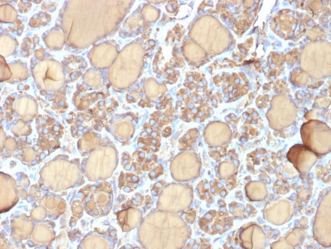 Thyroglobulin (Thyroidal Cell Marker) Antibody in Immunohistochemistry (Paraffin) (IHC (P))