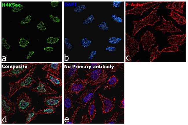 H4K5ac Antibody in Immunocytochemistry (ICC/IF)