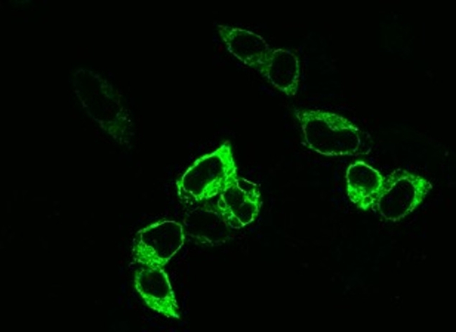 SSTR1 Antibody in Immunocytochemistry (ICC/IF)