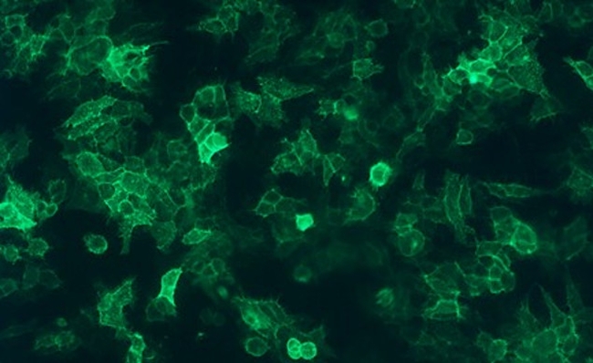 Endothelin A Receptor Antibody in Immunocytochemistry (ICC/IF)