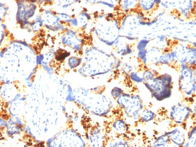 Transglutaminase II (TGM2) Antibody in Immunohistochemistry (Paraffin) (IHC (P))