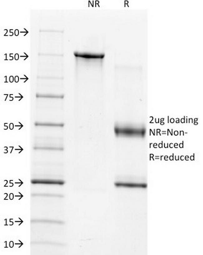 TIMP1 (Marker of Lymph Node Metastasis) Antibody in SDS-PAGE (SDS-PAGE)