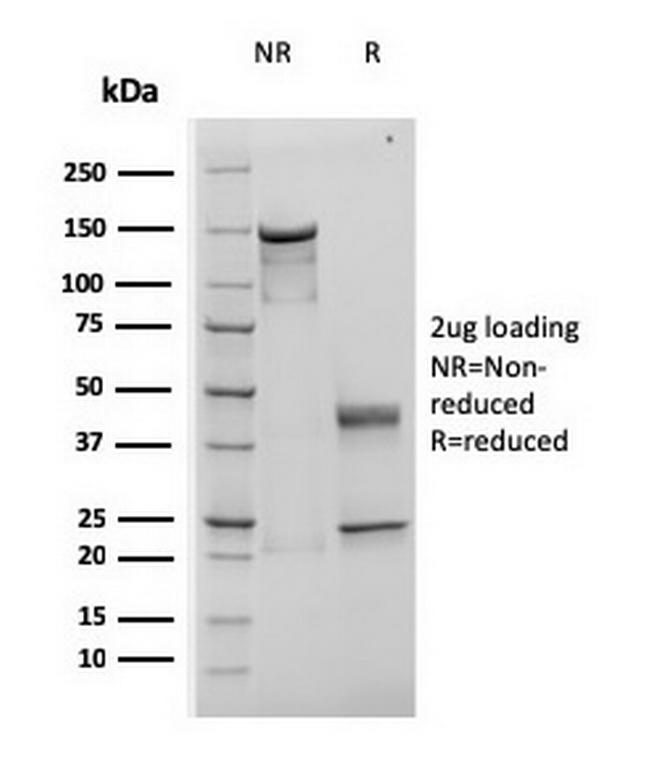 TIMP1 (Colorectal Cancer Biomarker/Marker of Lymph Node Metastasis) Antibody in SDS-PAGE (SDS-PAGE)