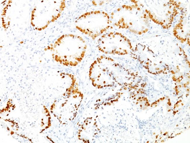 TTF-1/NKX2.1 (Thyroid and Lung Epithelial Marker) Antibody in Immunohistochemistry (Paraffin) (IHC (P))