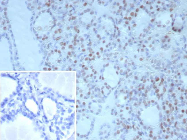 TTF-1/NKX2.1 (Thyroid and Lung Epithelial Marker) Antibody in Immunohistochemistry (Paraffin) (IHC (P))