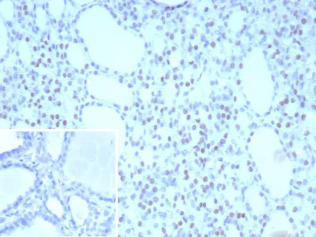 TTF-1/NKX2.1 (Thyroid and Lung Epithelial Marker) Antibody in Immunohistochemistry (Paraffin) (IHC (P))