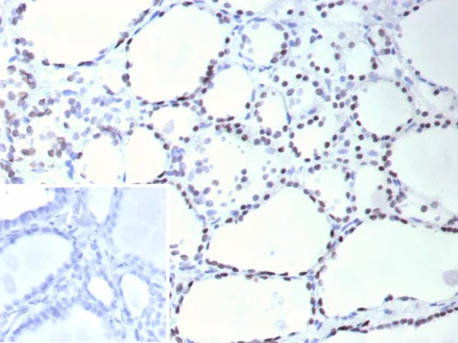 TTF-1/NKX2.1 (Thyroid and Lung Epithelial Marker) Antibody in Immunohistochemistry (Paraffin) (IHC (P))