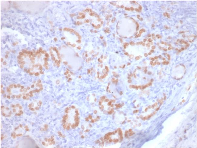 TTF-1/NKX2.1 Antibody in Immunohistochemistry (Paraffin) (IHC (P))