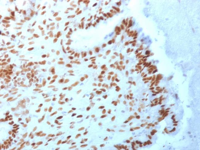 TLE1 (Synovial Sarcoma Marker) Antibody in Immunohistochemistry (Paraffin) (IHC (P))