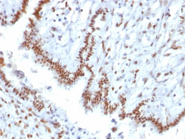 TLE1 (Synovial Sarcoma Marker) Antibody in Immunohistochemistry (Paraffin) (IHC (P))