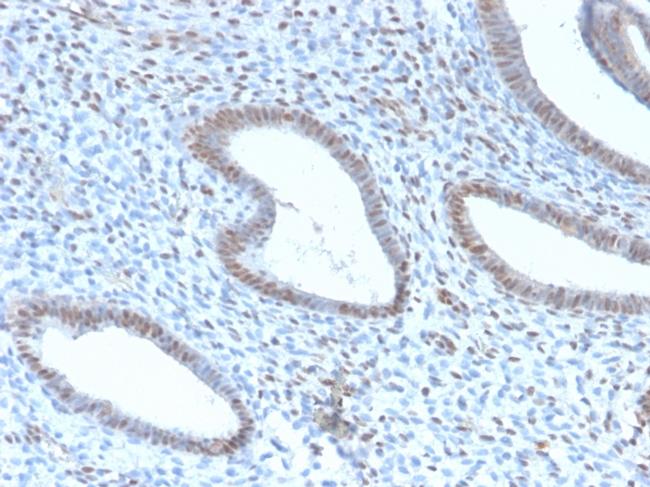 TLE1 Antibody in Immunohistochemistry (Paraffin) (IHC (P))