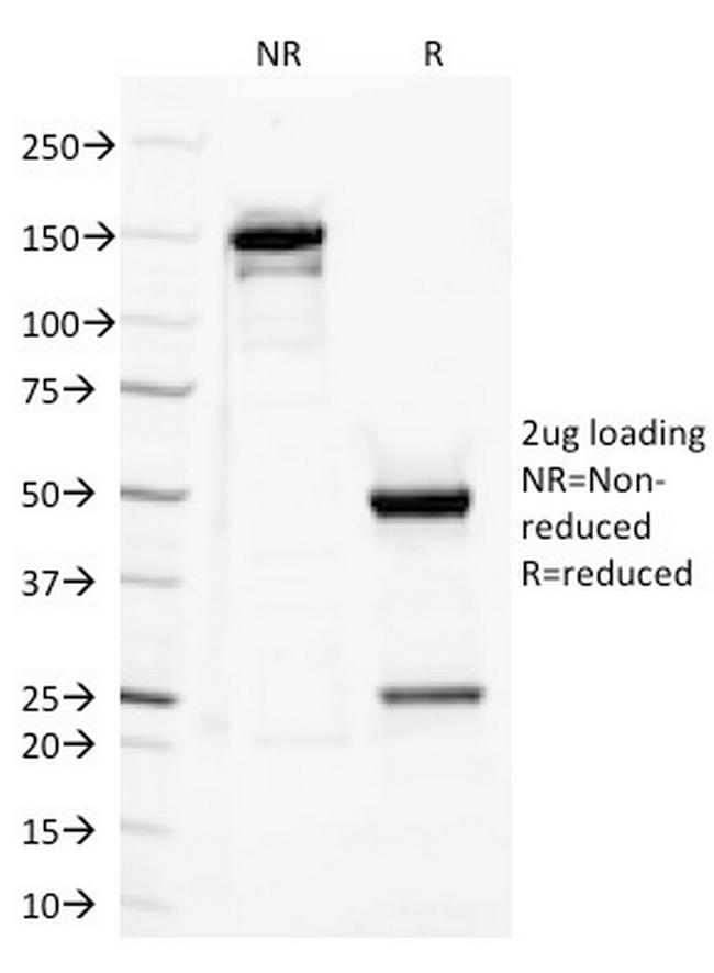 CD282 (Toll-Like Receptor 2) Antibody in SDS-PAGE (SDS-PAGE)