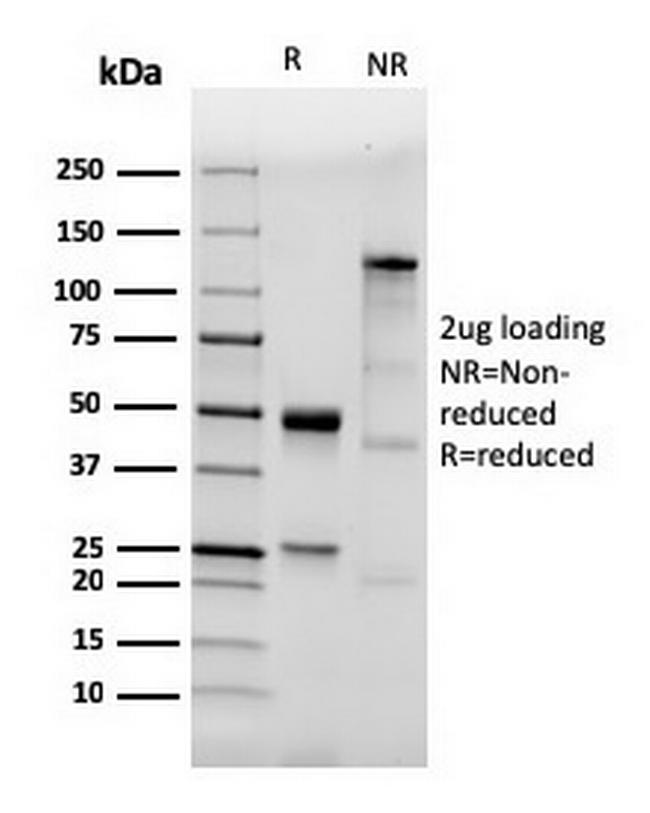 CD282 (Toll-Like Receptor 2) Antibody in SDS-PAGE (SDS-PAGE)