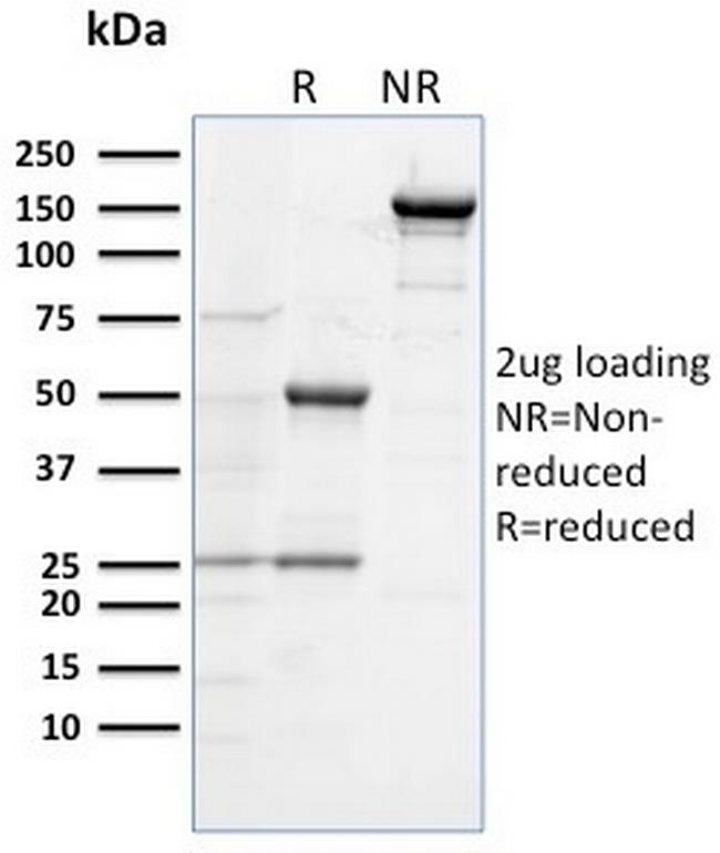 CD284 (Toll-Like Receptor 4) Antibody in SDS-PAGE (SDS-PAGE)