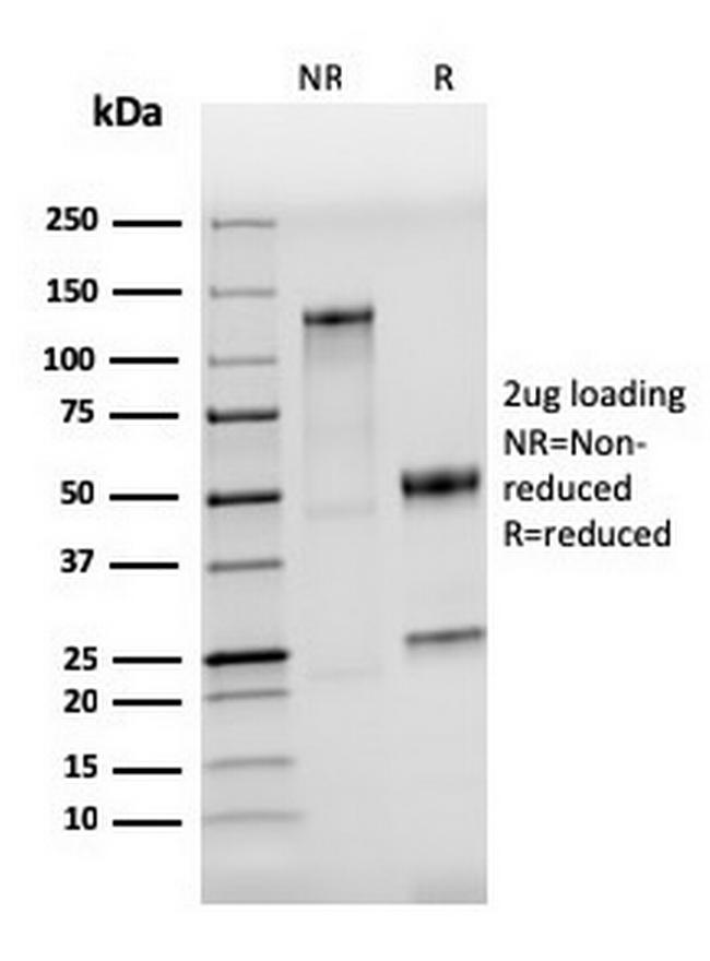 CD284 (Toll-Like Receptor 4) Antibody in SDS-PAGE (SDS-PAGE)