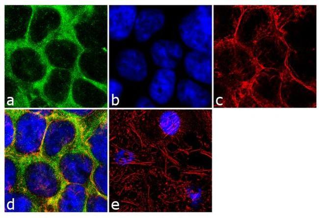 CCL5 (RANTES) Antibody in Immunocytochemistry (ICC/IF)