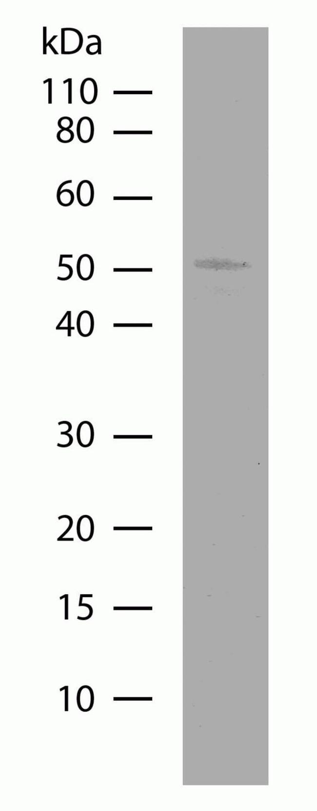 PEP12 Antibody in Western Blot (WB)