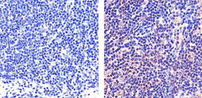 STAT5 alpha Antibody in Immunohistochemistry (Paraffin) (IHC (P))