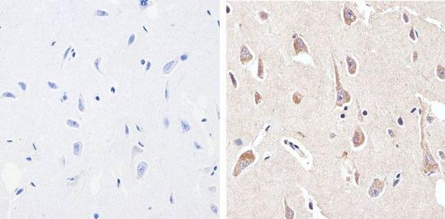 Phospho-PYK2 (Tyr402) Antibody in Immunohistochemistry (Paraffin) (IHC (P))