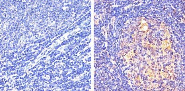 Phospho-STAT5 alpha (Tyr694) Antibody in Immunohistochemistry (Paraffin) (IHC (P))