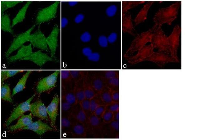 FAK Antibody in Immunocytochemistry (ICC/IF)