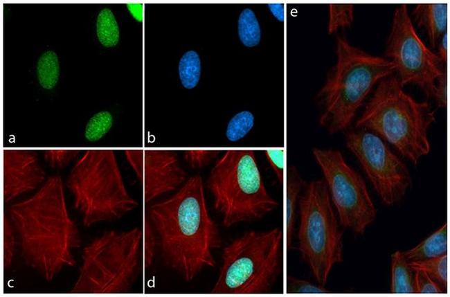 Phospho-Tau (Thr231) Antibody in Immunocytochemistry (ICC/IF)