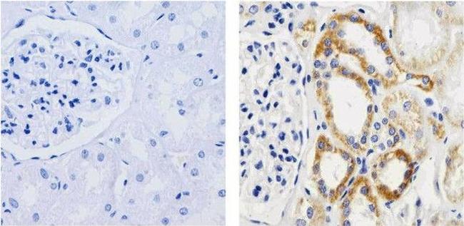 IkB alpha Antibody in Immunohistochemistry (Paraffin) (IHC (P))