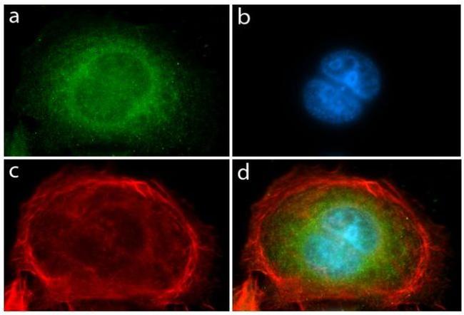 PDGFRA Antibody in Immunocytochemistry (ICC/IF)