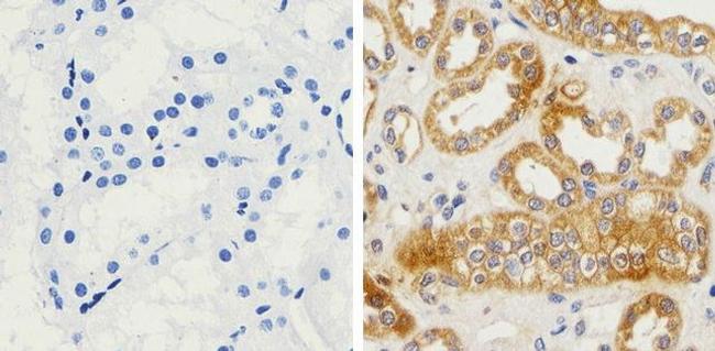 beta Amyloid Antibody in Immunohistochemistry (Paraffin) (IHC (P))